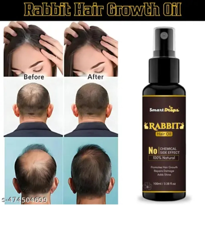 SmartDrops Rabbit Hair Oil – तेज़ बाल बढ़ाने वाला और हेयर फॉल कंट्रोल करने वाला 100% नेचुरल तेल