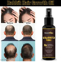 SmartDrops Rabbit Hair Oil – तेज़ बाल बढ़ाने वाला और हेयर फॉल कंट्रोल करने वाला 100% नेचुरल तेल
